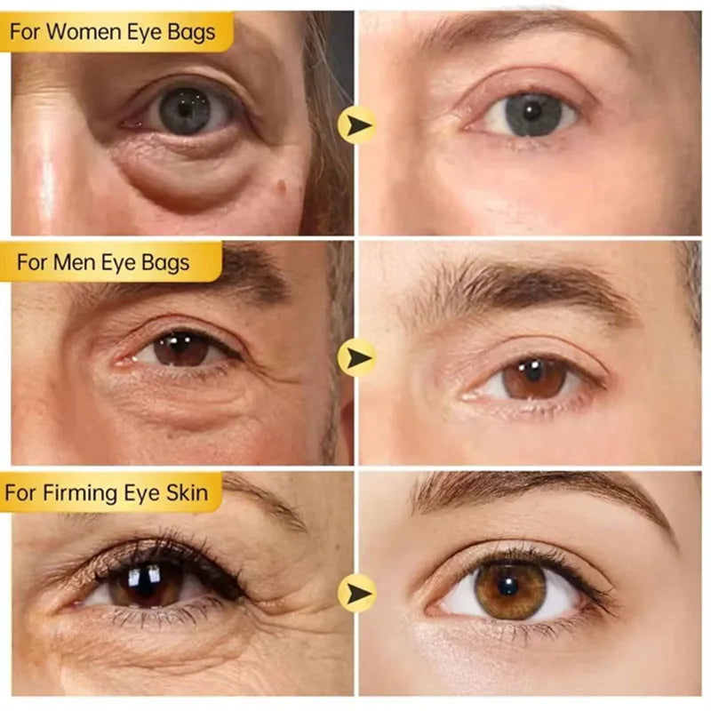 Instant Eye Bag Remove Eye Cream Anti Fat Particles Dark Circles Puffiness Fade Fine Lines Lift Brighten Korean Beauty Eye Care