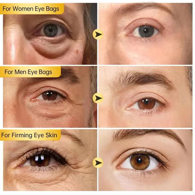 Instant Eye Bag Remove Eye Cream Anti Fat Particles Dark Circles Puffiness Fade Fine Lines Lift Brighten Korean Beauty Eye Care