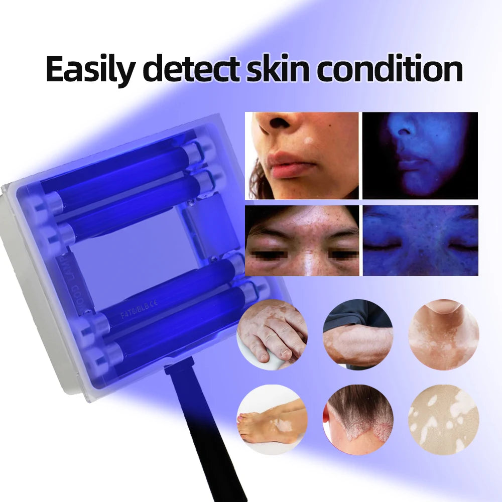 AOKO Wood UV Lamp Skin Appraisal Analyzer Facial Skin Vitiligo Testing Examination Magnifying Machine Greyness Skin Tinea
