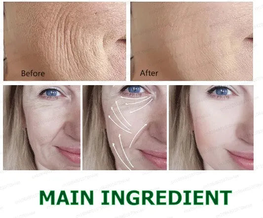 20 ʏᴇᴀʀs ʏᴏᴜɴɢᴇʀ! Aɴᴛɪ-ᴡʀɪɴᴋʟᴇ, ғɪʀᴍɪɴɢ, ʟɪɢʜᴛ ʟɪɴᴇs ʀᴇᴘᴀɪʀ