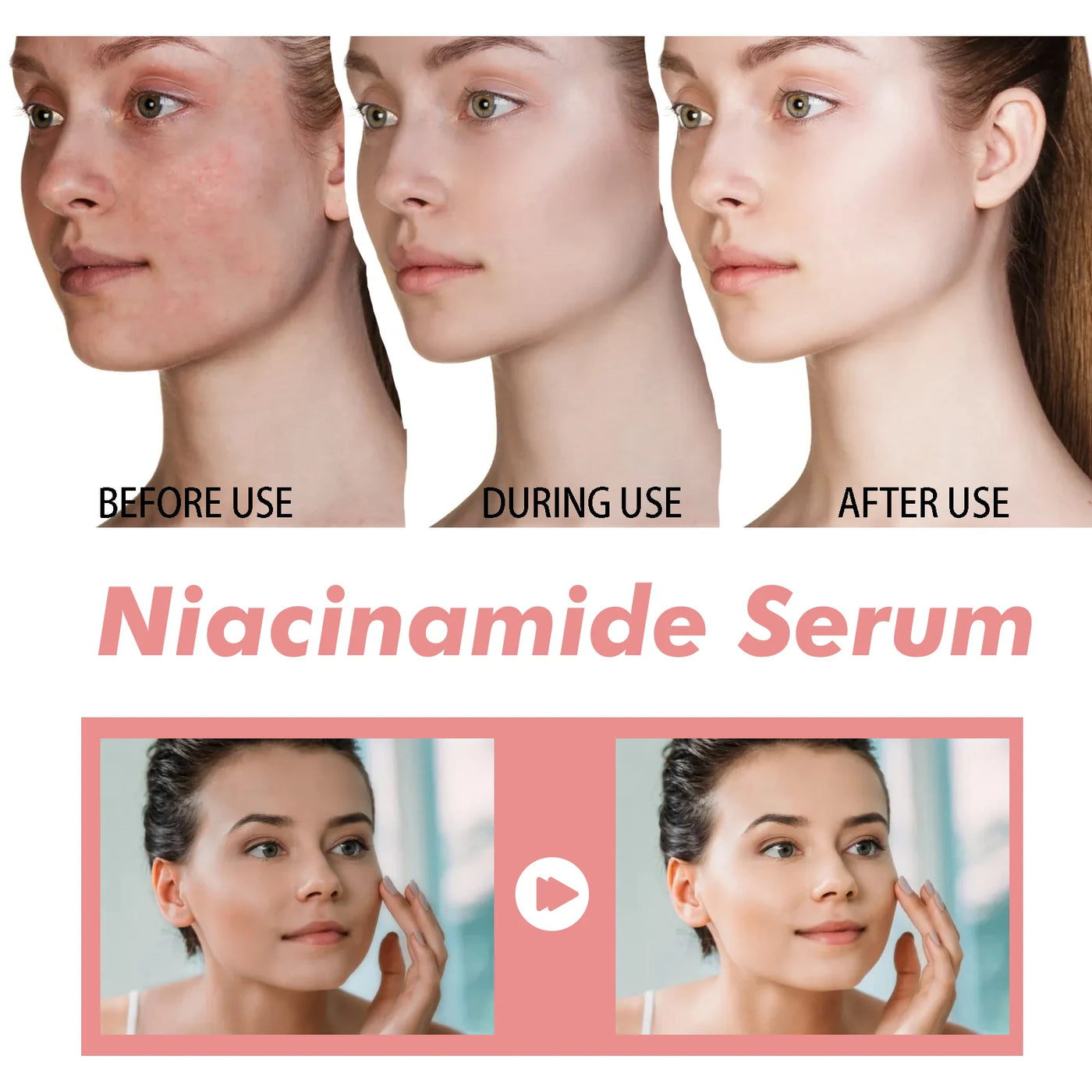 Niacinamide Serum Brightening Complexion Nourishing Hydrating Rejuvenating Serum Pore Contouring Hyaluronic Acid Soothing Skin