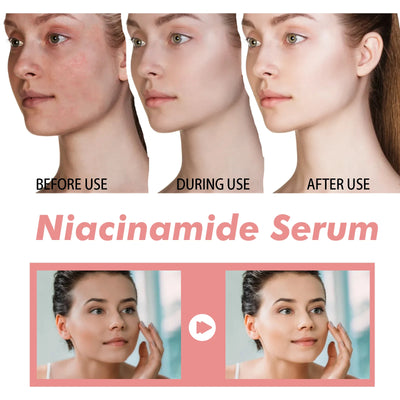 Niacinamide Serum Brightening Complexion Nourishing Hydrating Rejuvenating Serum Pore Contouring Hyaluronic Acid Soothing Skin