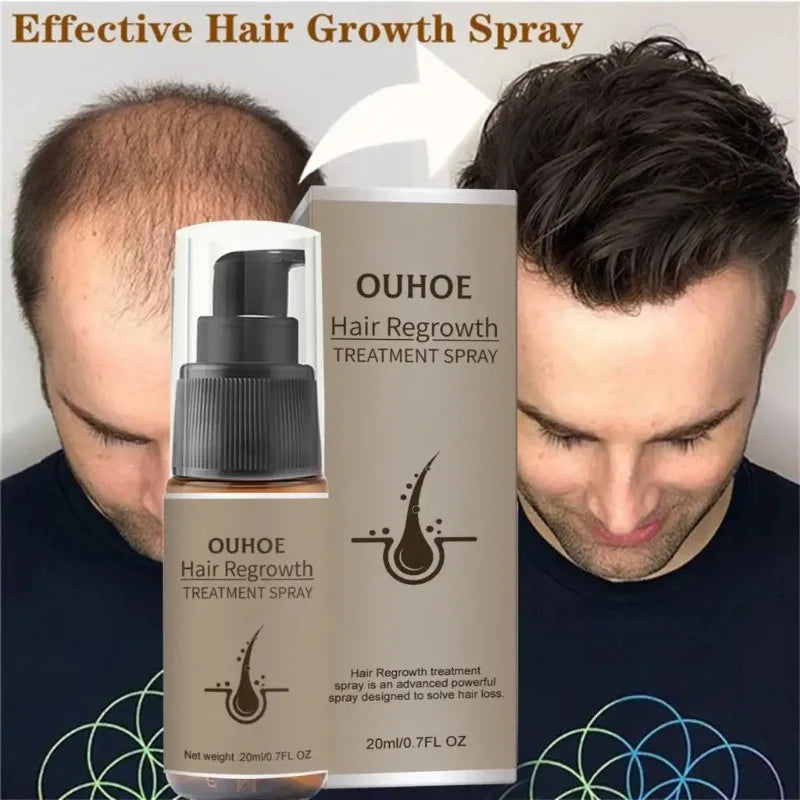 Hair Growth Serum Spray Ginger Anti Hair Loss Treatment Products Repair Nourish hair Roots Fast Regrowth Men Women