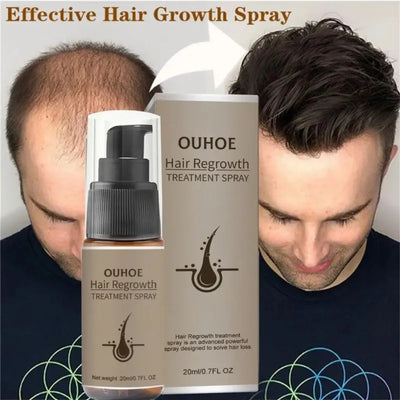Hair Growth Serum Spray Ginger Anti Hair Loss Treatment Products Repair Nourish hair Roots Fast Regrowth Men Women