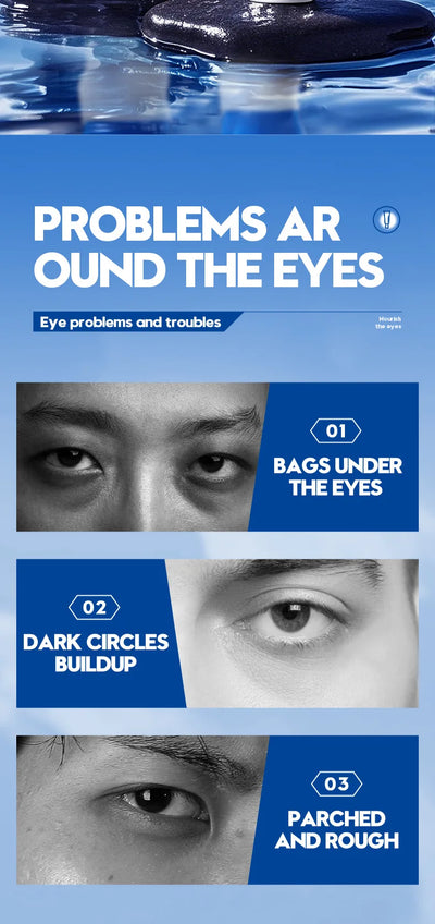 Men's Eye Cream Anti Dark Circles Removal Eye Bags Moisturizing Anti-Aging Anti-wrinkles Men Eyes Skin Care