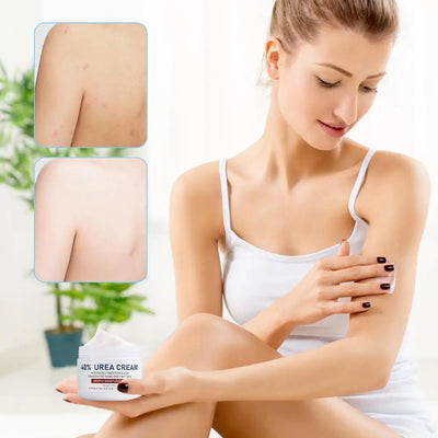 1pcs 150g Urea Cream 40% Urea Cream Anti-dry Cracking Moisturizing Hydration Hand and Foot Cream