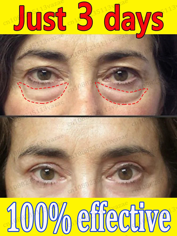 stay up late eye essence,keep your eyes forever young