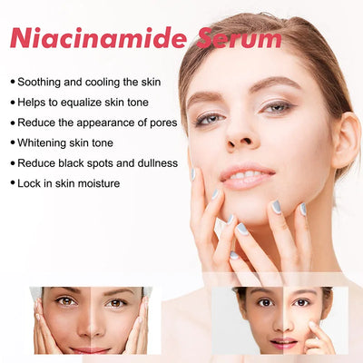 Niacinamide Serum Brightening Complexion Nourishing Hydrating Rejuvenating Serum Pore Contouring Hyaluronic Acid Soothing Skin