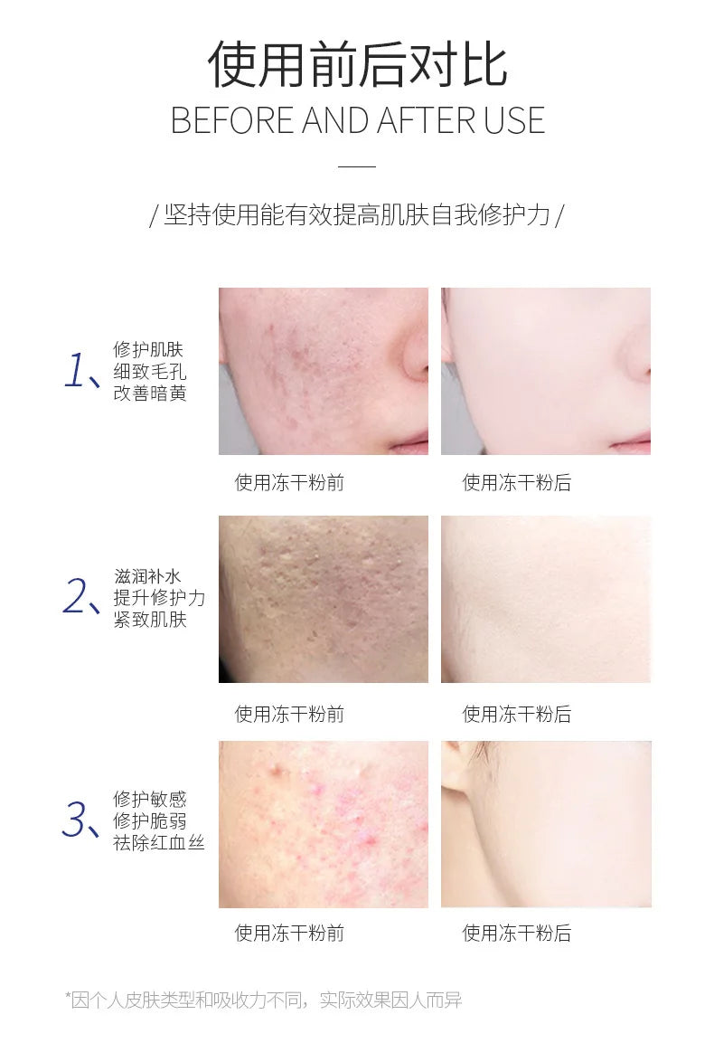 Oligopeptide Lyophilized Powder 5 Pairs Repair Hydration Moisturizing High Active Essence Original Deep Brighten Skin Care