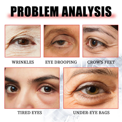 Eye Lifting Serum Anti Dark Circles Puffiness Reduce Fine Lines Wrinkle Firming Nourishing Brightening Eye Bags Remover Essence