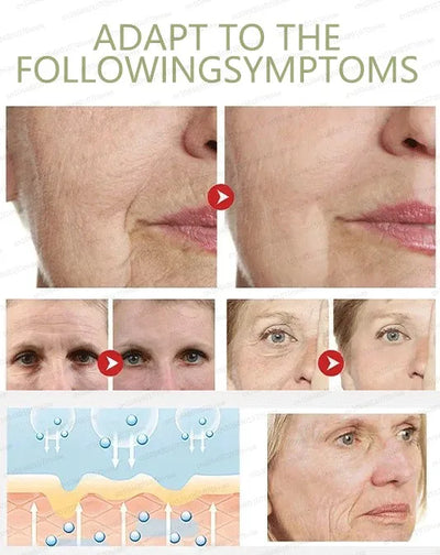 20 ʏᴇᴀʀs ʏᴏᴜɴɢᴇʀ! Aɴᴛɪ-ᴡʀɪɴᴋʟᴇ, ғɪʀᴍɪɴɢ, ʟɪɢʜᴛ ʟɪɴᴇs ʀᴇᴘᴀɪʀ