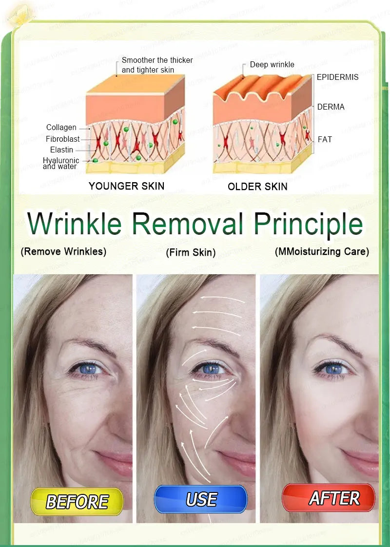 20 years younger，100% wrinkles disappear