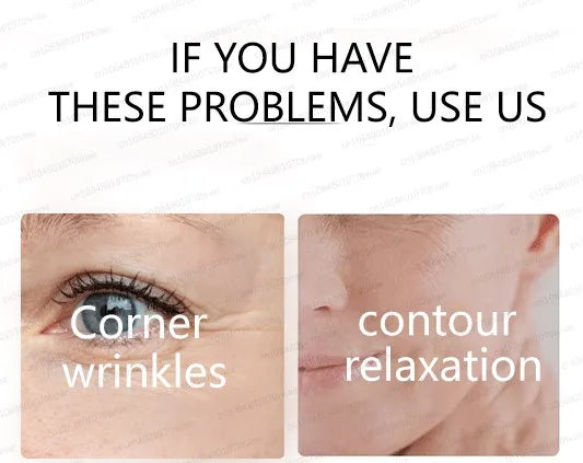 20 ʏᴇᴀʀs ʏᴏᴜɴɢᴇʀ! Aɴᴛɪ-ᴡʀɪɴᴋʟᴇ, ғɪʀᴍɪɴɢ, ʟɪɢʜᴛ ʟɪɴᴇs ʀᴇᴘᴀɪʀ