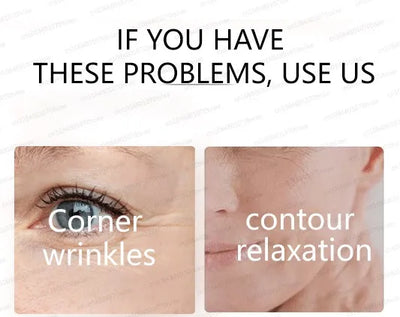 20 ʏᴇᴀʀs ʏᴏᴜɴɢᴇʀ! Aɴᴛɪ-ᴡʀɪɴᴋʟᴇ, ғɪʀᴍɪɴɢ, ʟɪɢʜᴛ ʟɪɴᴇs ʀᴇᴘᴀɪʀ