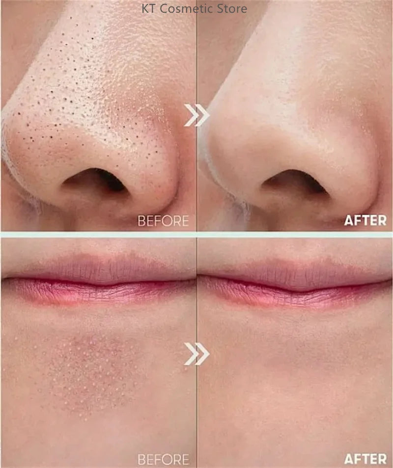 Black White Rice Peel Shot Glow Rice Ampoule Duo Exfoliate Dead Skin Closed Pimples Moisturize Brighten Smooth Pores Care Korea