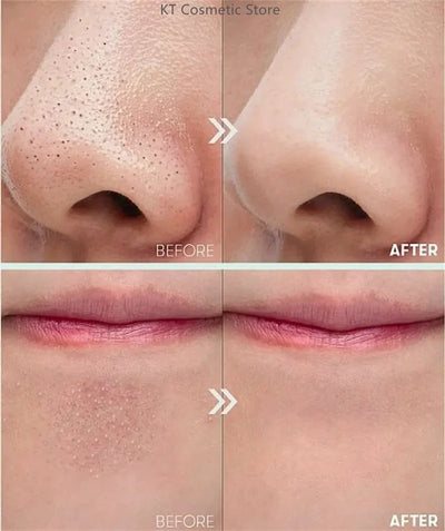 Black White Rice Peel Shot Glow Rice Ampoule Duo Exfoliate Dead Skin Closed Pimples Moisturize Brighten Smooth Pores Care Korea