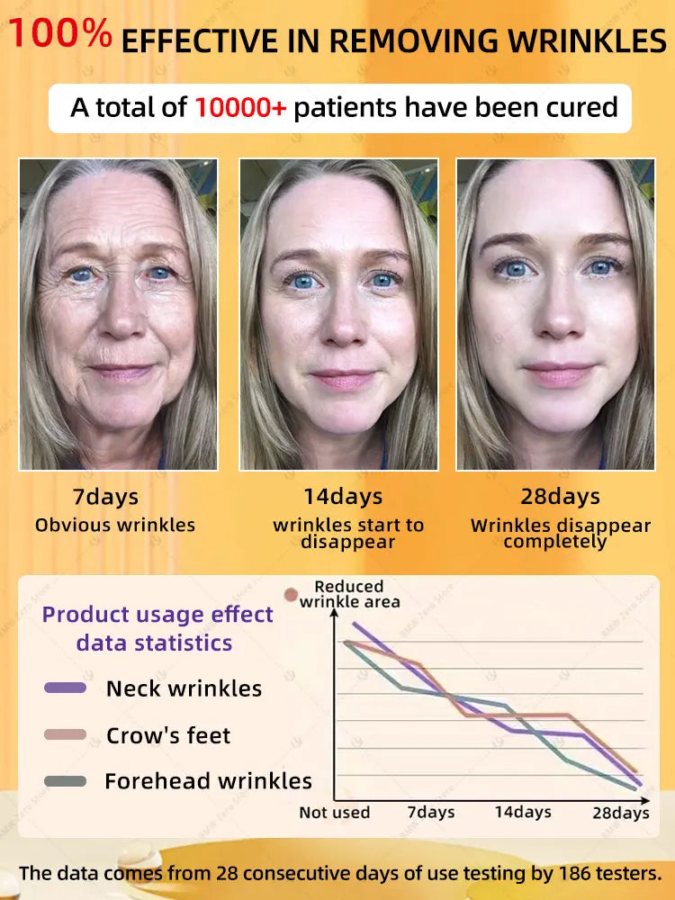 20 years younger, 100% wrinkles disappear