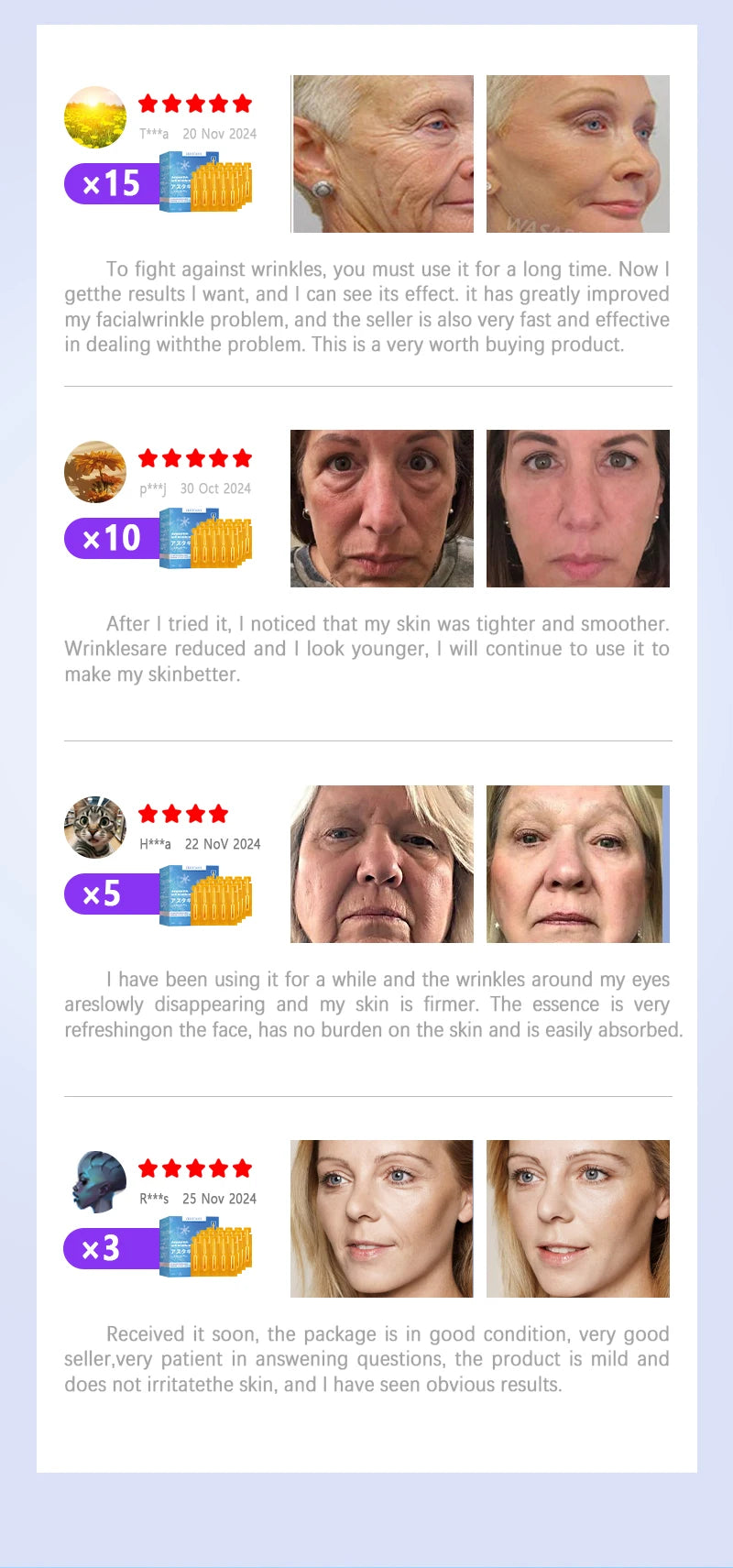 20 ʏᴇᴀʀs ʏᴏᴜɴɢᴇʀ! Aɴᴛɪ-ᴡʀɪɴᴋʟᴇ, ғɪʀᴍɪɴɢ, ʟɪɢʜᴛ ʟɪɴᴇs ʀᴇᴘᴀɪʀ