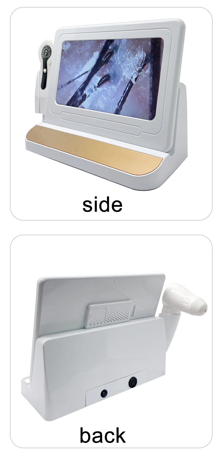 NEW 10 Inch LCD Skin&Hair Scalp Analyzer Detector Digital Microscope Magnifier Skin Hair Blackhead Follicle Detection 50X-200X