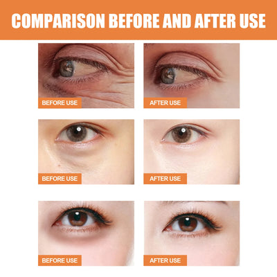 Vitamin C Eye Balm Anti Wrinkle Moisturizing Eye Bag Removal Dark Circles Reduce Fine Lines Anti Puffiness Brightening Eye Care