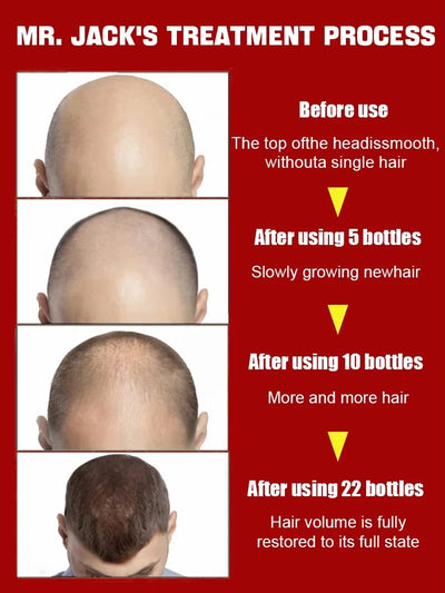 ᵀʰⁱᶜᵏ ʰᵃⁱʳ⸴ ᵗʰⁱᶜᵏ ᵇᵉᵃʳᵈ⸴ ᵗʰⁱᶜᵏ ˡᵉᵍ ʰᵃⁱʳ⸴ ᵗʰⁱᶜᵏ ᶜʰᵉˢᵗ ʰᵃⁱʳ