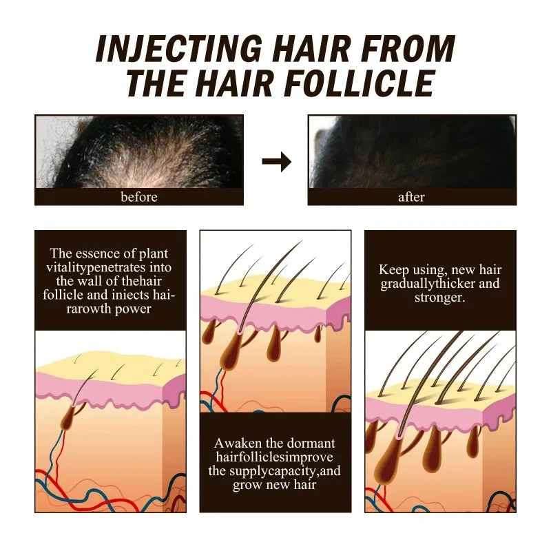 Hair Growth Serum Spray Ginger Anti Hair Loss Treatment Products Repair Nourish hair Roots Fast Regrowth Men Women