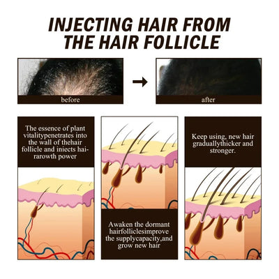 Hair Growth Serum Spray Ginger Anti Hair Loss Treatment Products Repair Nourish hair Roots Fast Regrowth Men Women