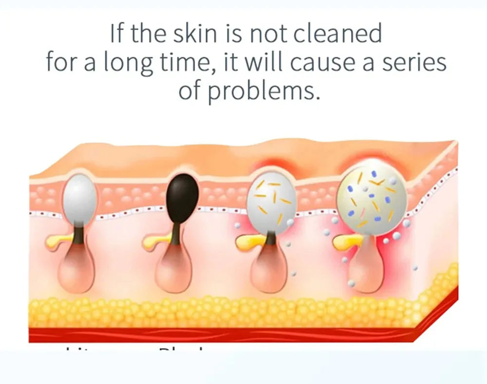 2IN1 Vacuum Acne Pore Cleaner Small Bubble Blackhead Remover Skin Deep Cleaning Beauty Care Tools Moisturizing Beauty Instrument