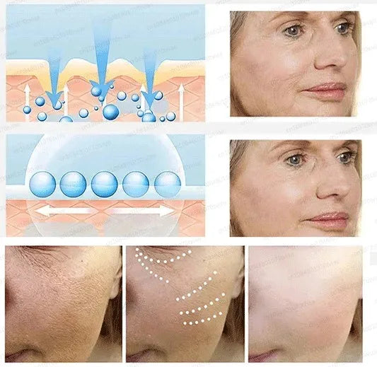 20 ʏᴇᴀʀs ʏᴏᴜɴɢᴇʀ! Aɴᴛɪ-ᴡʀɪɴᴋʟᴇ, ғɪʀᴍɪɴɢ, ʟɪɢʜᴛ ʟɪɴᴇs ʀᴇᴘᴀɪʀ