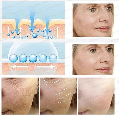 20 ʏᴇᴀʀs ʏᴏᴜɴɢᴇʀ! Aɴᴛɪ-ᴡʀɪɴᴋʟᴇ, ғɪʀᴍɪɴɢ, ʟɪɢʜᴛ ʟɪɴᴇs ʀᴇᴘᴀɪʀ