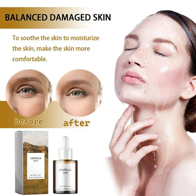 Centella Asiatica Face Serum Nourish Dry Skin Smoothing Rejuvenation Skin Brightening Whitening Cream Facial Moisturizer Korean