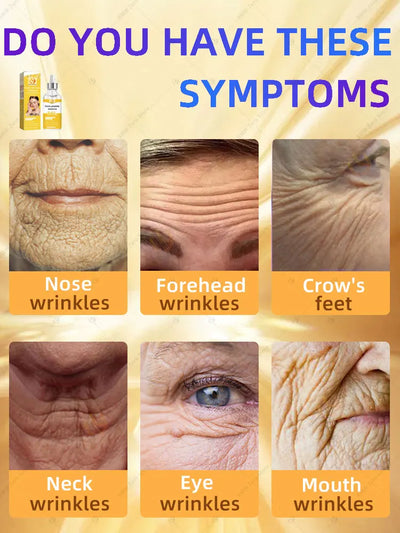 20 years younger, 100% wrinkles disappear