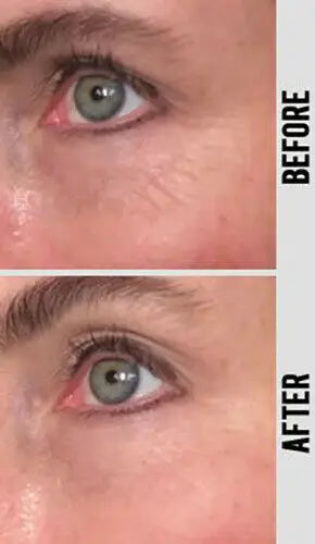 PURE RETINOL SERUM 5% HYALURONIC ACID RETINOL FACE CREAM 30ml Anti-aging Anti-wrinkle Exfoliate Skin Care Firming