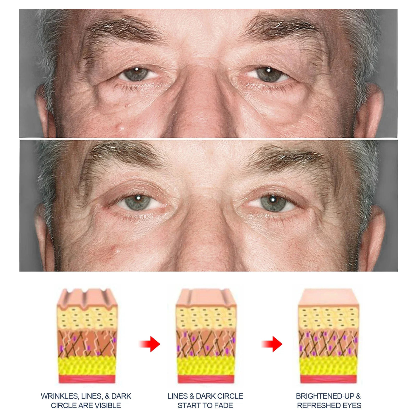 Men Retinol Eye Bags Remover Cream