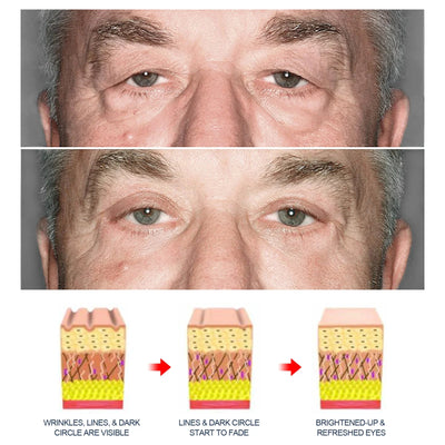 Men Retinol Eye Bags Remover Cream