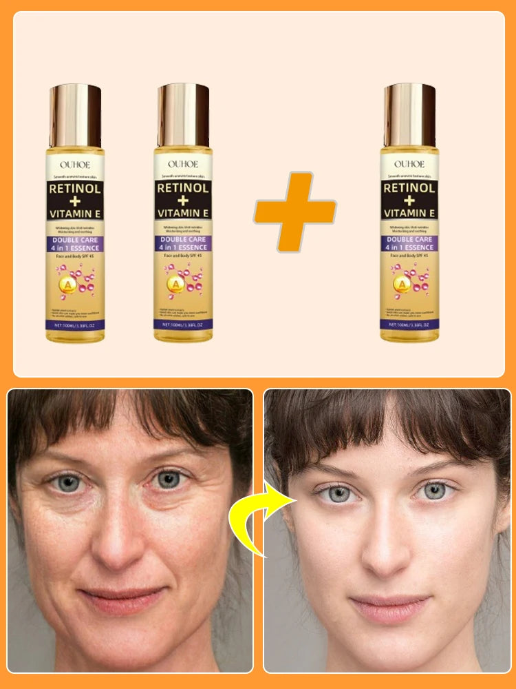 Wrinkles disappear permanently