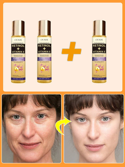 Wrinkles disappear permanently