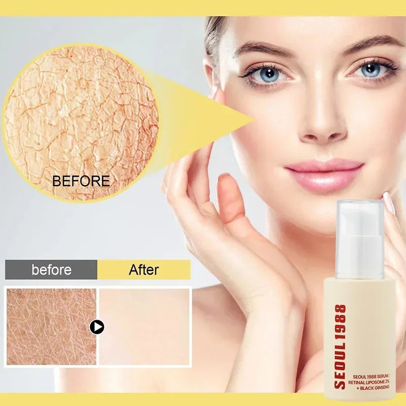 Seoul 1988 Eye Cream Niacinamide Retinoic Acid Ginseng Essence Firm Cream Lighten Fine Lines Deep Moisturizing Care Essence Set