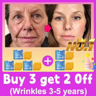 20 ʏᴇᴀʀs ʏᴏᴜɴɢᴇʀ! Aɴᴛɪ-ᴡʀɪɴᴋʟᴇ, ғɪʀᴍɪɴɢ, ʟɪɢʜᴛ ʟɪɴᴇs ʀᴇᴘᴀɪʀ