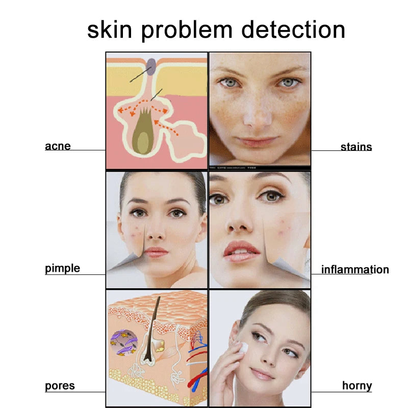 50/200X Charging Scalp Detector Digital Hair Skin Analyzer Microscope For Hair Follicle Testing and Skin Analysis Magnifier NEW