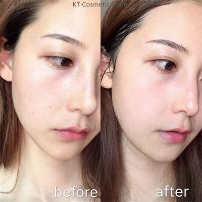 Black White Rice Peel Shot Glow Rice Ampoule Duo Exfoliate Dead Skin Closed Pimples Moisturize Brighten Smooth Pores Care Korea