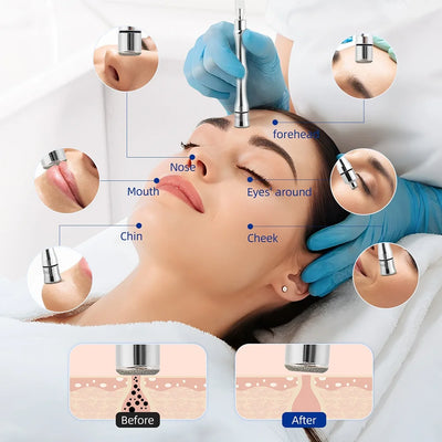 9 Tips 3 Wands Diamond Dermabrasion Accessory Tips For Facial Skin Peeling Blackhead Remover Face Care Beauty