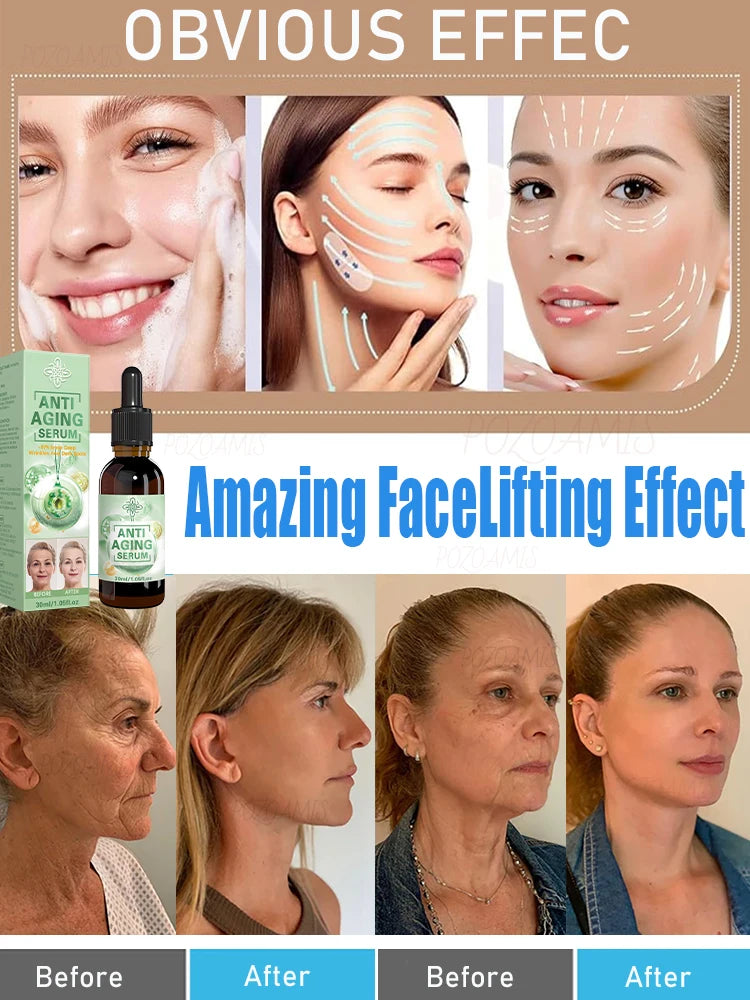 20 years younger，100% wrinkles disappear