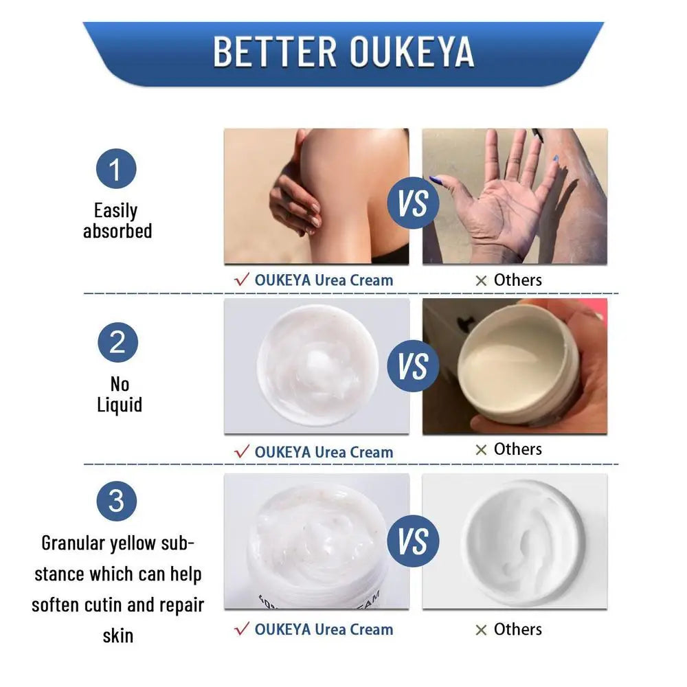 1pcs 150g Urea Cream 40% Urea Cream Anti-dry Cracking Moisturizing Hydration Hand and Foot Cream