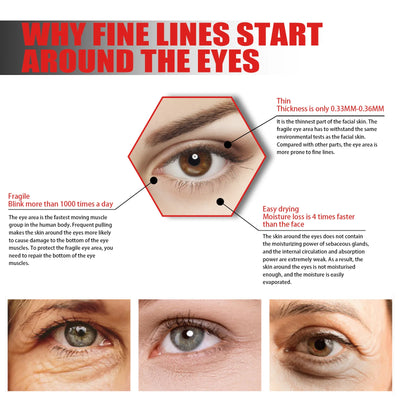 Eye Lifting Serum Anti Dark Circles Puffiness Reduce Fine Lines Wrinkle Firming Nourishing Brightening Eye Bags Remover Essence