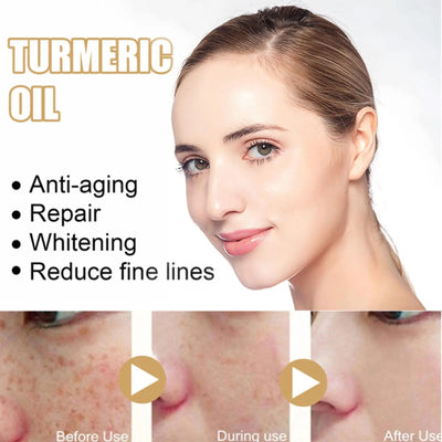 Ginger Turmeric Face Essence Oil Black Spots Remove Repair Aging Whitening Serum Skin Removal Moisturizing Wrinkles Oil Ant