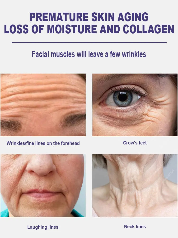 20 ʏᴇᴀʀs ʏᴏᴜɴɢᴇʀ! Aɴᴛɪ-ᴡʀɪɴᴋʟᴇ, ғɪʀᴍɪɴɢ, ʟɪɢʜᴛ ʟɪɴᴇs ʀᴇᴘᴀɪʀ