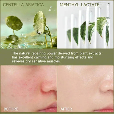 7 Day Repair Redness Serum Sooth Itching Sensitive Skin Improve Rosacea Shrink Pore Smooth Nourish Facial Skin Korean Cosmetics