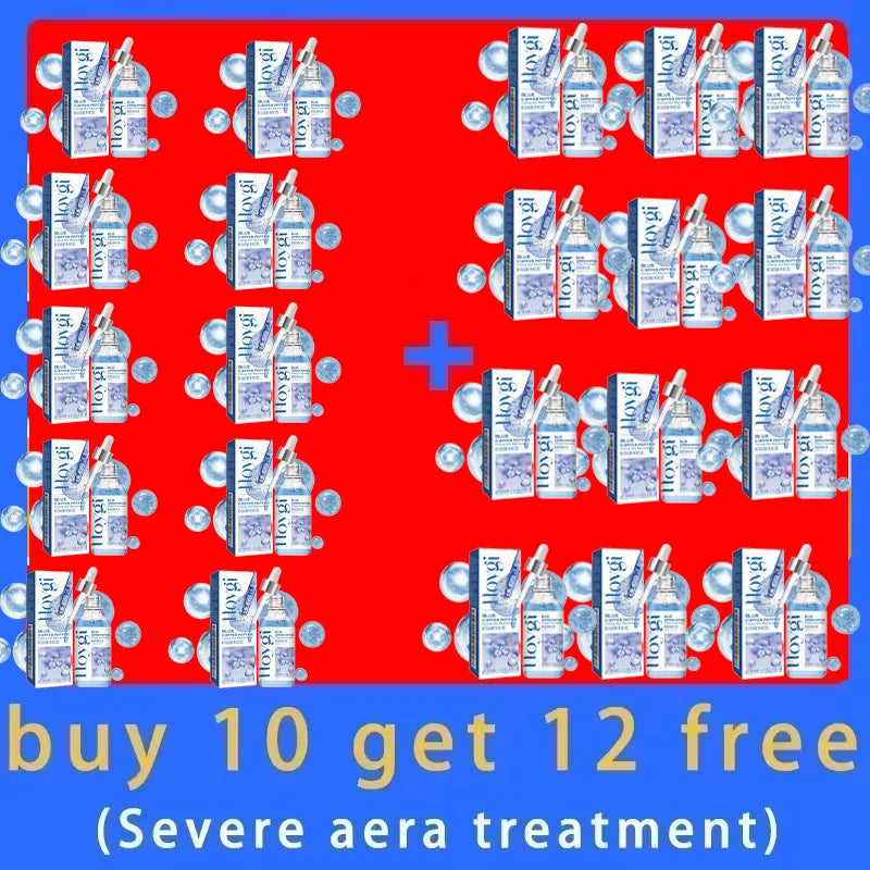 High end wrinkle essence, fast absorption makes you 20 years younger