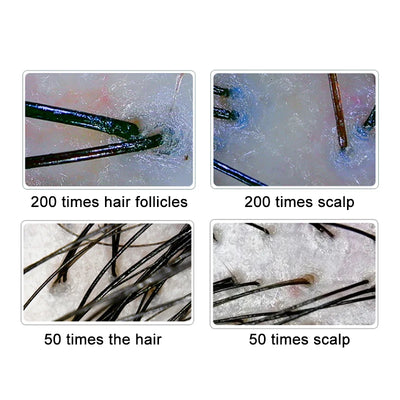 NEW 10 Inch LCD Skin&Hair Scalp Analyzer Detector Digital Microscope Magnifier Skin Hair Blackhead Follicle Detection 50X-200X